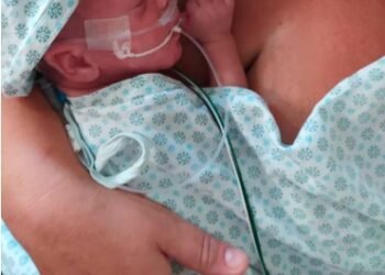 Campanha Novembro Roxo lembra importância da sensibilização sobre prematuridade de bebês