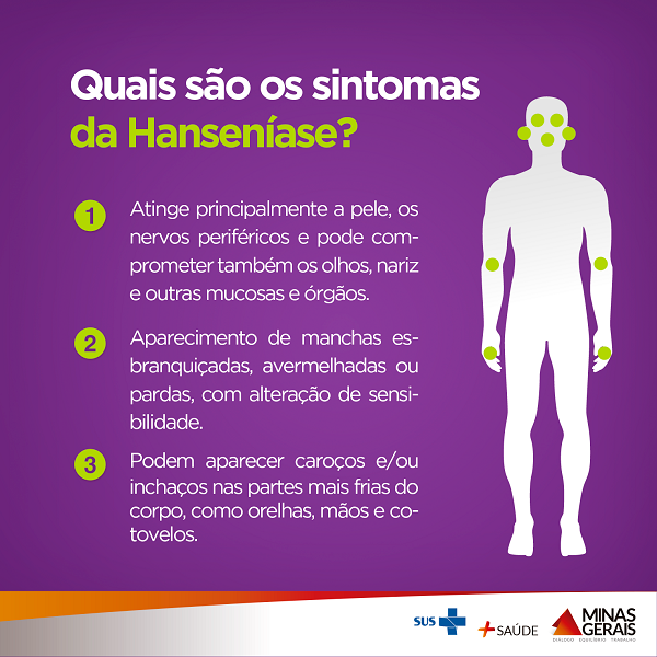 Hanseníase: o que é, causas, sinais e sintomas, tratamento, diagnóstico e  prevenção - Med Mais Vacina