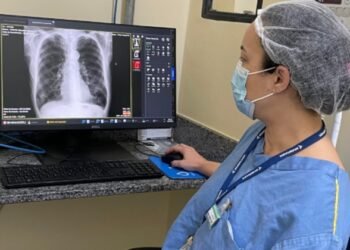 Tuberculose: atuação intersetorial e ações prioritárias de controle da doença vão qualificar o atendimento e promover cuidado efetivo para reduzir casos e óbitos