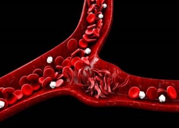Protocolo de tratamento inclui dois medicamentos usados para o tratamento de pacientes com doença falciforme