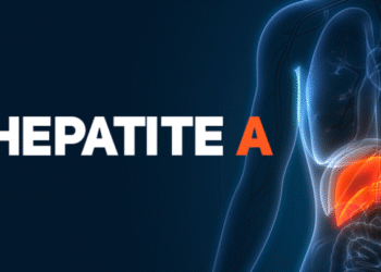 Alerta: casos de hepatite A aumentam em todas as regiões do Brasil